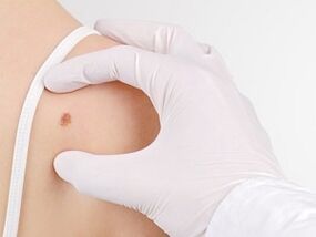 What is the danger of having papiles in the body