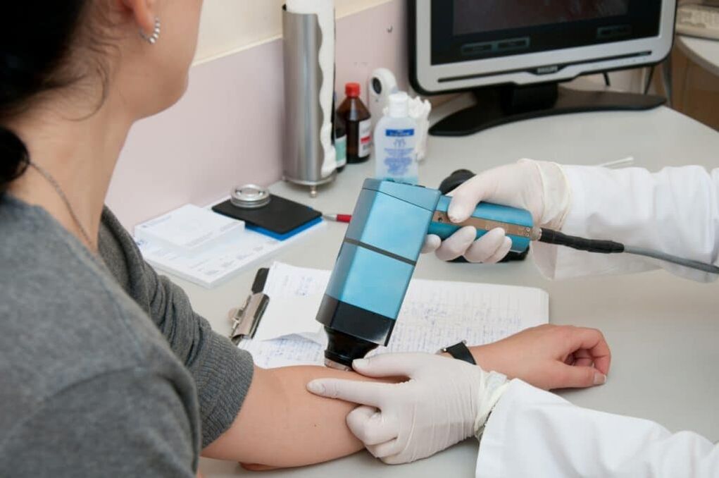 Methods of treatment of warts on the body